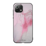 Xiaomi Mi 11 Lite marmori suojakuoret - Pink Pok Rie - Ei